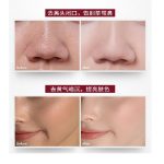 果酸水杨酸精华液