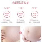 孕妇腹膜